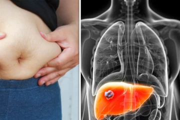 உங்களுக்கு வயிறு வீக்கம் இருந்தால் இந்த நோயாக இருக்கலாம்.. கவனிக்காமல் விட்டால் என்ன நடக்கும் தெரியுமா?