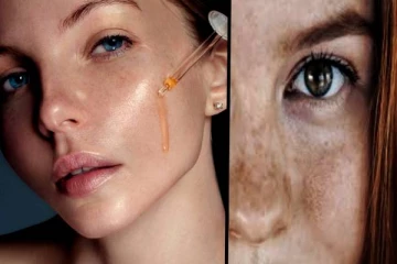 முக கருமை என்ன செய்தாலும் மாறவில்லையா? அப்போ இந்த க்ரீம் பூசுங்க- தீர்வு நிச்சயம்