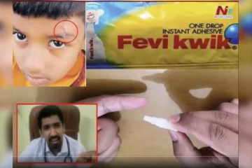 பெவிகுயிக் போட்டு வெட்டுக் காயத்திற்கு சிகிச்சை பார்த்த மருத்துவர்: சீல் வைத்த அதிகாரிகள்