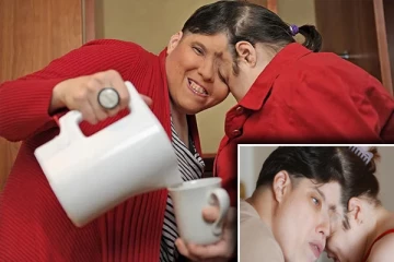 உலகின் மிக வயதான ஒட்டிப்பிறந்த இரட்டை சகோதரிகள் மரணம்!