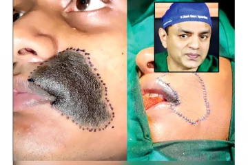 இலங்கையில் நடந்த அபூர்வ சத்திர சிகிச்சை - அழகாக மாறிய இளைஞன் (Video)