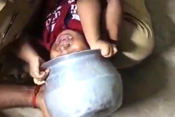 தலையில் சிக்கிய பாத்திரம்; நீண்ட நேரம் போராடிய பெற்றோர் - குழந்தையின் நிலை?