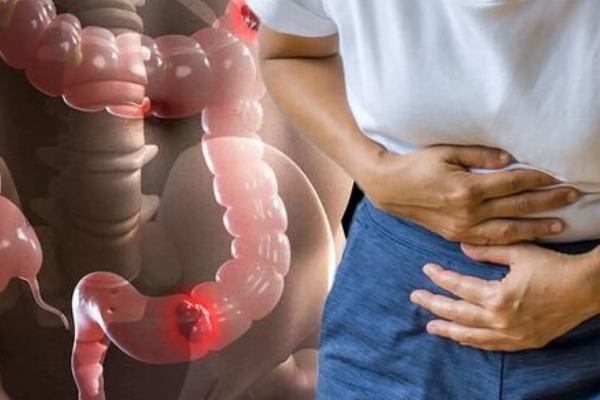 நீரிழிவு நோயை விரட்டியடிக்கும் இந்த அரிசி! | Red Rice That Repels Diabetes