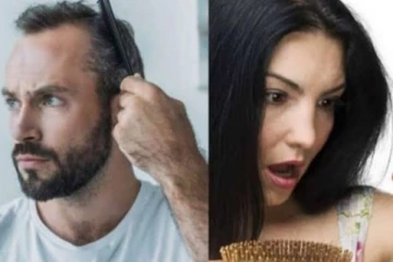 ஒரே வாரத்தில் முடி உதிர்தலை கட்டுப்படுத்த வேண்டுமா? அருமையான வீட்டு வைத்தியம் இதோ!