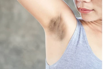 அக்குள் கருப்பா இருக்கா... நொடியில் வெள்ளையாக்க இதை மட்டும் போடுங்க!