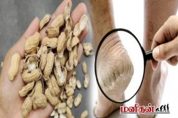 வேர்க்கடலை தோலை இனி வீசாதீங்க - குதிகால் வெடிப்பிற்கு தீர்வு