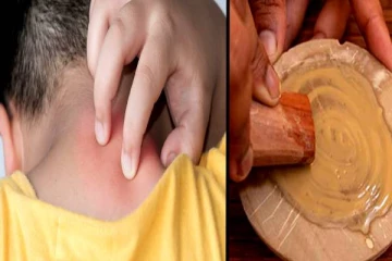 கோடைக்காலம் வந்தாச்சு.. வேர்க்குரு தொல்லையா? அப்போ ஈஸியாக போக்க ஒரு டிப்ஸ்!