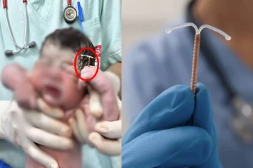 கருத்தடை சாதனத்தை கையில் பிடித்தபடி பிறந்த குழந்தை - அதிர்ச்சியில் மருத்துவர்கள்