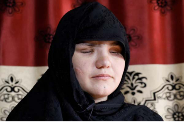 நாய்களுக்கு விருந்தாகும் பெண்கள்: அன்று தாலிபான்களால் 8 முறை சுடப்பட்ட கர்ப்பிணி! பகீர் உண்மை | Afghanistan Mum Tortured Taliban Fighters