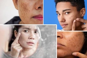 முகத்தில் கரும்புள்ளியா... இதை மட்டும் செய்யுங்கள் ஒரே நாளில் பலன்