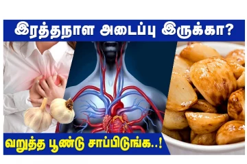 இரத்தநாள அடைப்பு இருக்கா? வறுத்த பூண்டு சாப்பிடுங்கள்