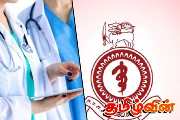 தொழிற்சங்க நடவடிக்கை தீவிரமாகும் - வைத்தியர்கள் எச்சரிக்கை