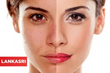 வெயிலினால் ஏற்படும் சரும பாதிப்பை சரி செய்ய வேண்டுமா? இதோ சில குறிப்புகள் !