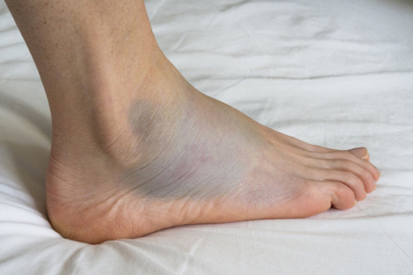 வெறும் வயிற்றில் ஒரு ஸ்பூன் நெய் சாப்பிடுவதால் இத்தனை நன்மைகளா? | Eating Spoonful Of Ghee On Empty Stomacha Dvantage