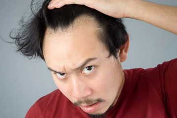 ஆண்களே! உங்க தலைமுடி சொட்டையாகி விட்டதா? நீங்க இத பண்ணா போதுமாம்...!