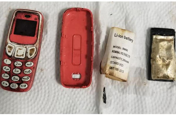 NOKIA செல்போனை விழுங்கிய நபர்! பரிசோதித்த டாக்டருக்கு காத்திருந்த அதிர்ச்சி.. பின்னர் நடந்தது என்ன? | Nokia Phone Swalloed By 33 Year Old Man