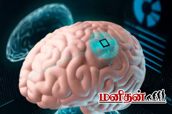அரிசி விட சிறிய மூளை சிப் கண்டுபிடிப்பு- மருத்துவ துறையில் புதிய புரட்சி | Scientists Create Brain Implant Smaller அரிசி விட சிறிய மூளை சிப் கண்டுபிடிப்பு- மருத்துவ துறையில் புதிய புரட்சி | Scientists Create Brain Implant Smaller