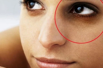 கருவளையத்தை எளிய முறையில் போக்க வேண்டுமா? இதோ சூப்பரான டிப்ஸ்!