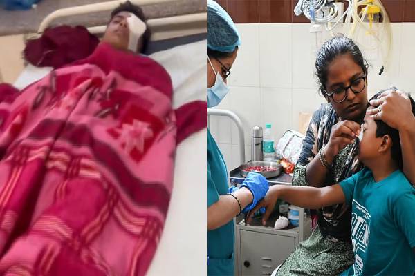 பட்டாசு வெடித்த 14 சிறுவர்களின் பார்வை பறிபோனது: அது என்ன பட்டாசு? | 14 Children Go Bilnd Play Diwali Carbide Gun In Mp