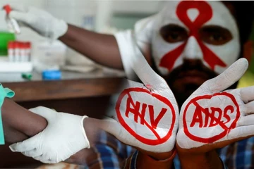இலங்கையில் எயிட்ஸ் மற்றும் சமூகவியாதிகளை பரிசோதிப்பதற்கான உபகரணங்களுக்குத் தட்டுப்பாடு