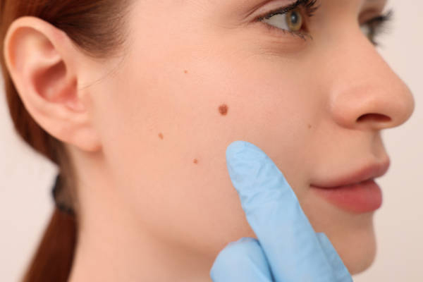 முகத்தில் இந்த இடத்தில் மச்சம் உள்ள பெண்கள் ரொம்ப அதிர்ஷ்டசாலியாம் | Woman Mole On Face Do You Know Benefits முகத்தில் இந்த இடத்தில் மச்சம் உள்ள பெண்கள் ரொம்ப அதிர்ஷ்டசாலியாம் | Woman Mole On Face Do You Know Benefits