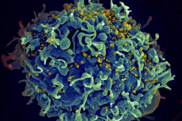 எய்ட்ஸ் பாதிப்பில் இருந்து சிகிச்சையே இல்லாமல் குணமடைந்த பெண் - மருத்துவ உலகம் வியப்பு