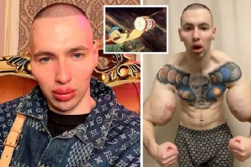 விபரீத சிகிச்சையால் வேற்றுகிரக வாசிகளின் தோற்றத்தை பெற்ற இளைஞன்!