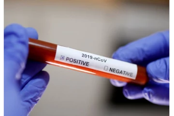 தமிழகத்தில் குறையும் கொரோனா பாதிப்பு: இன்றைய பாதிப்பு நிலவரம்