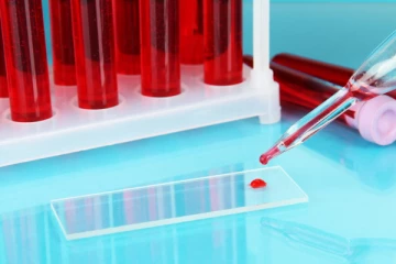 மனித இரத்தத்தில் பிளாஸ்டிக் நுண்துகள்! விஞ்ஞானிகள் பகீர் தகவல்