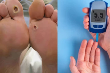 விஜயகாந்த் கால் விரல்கள் அகற்றம்! சர்க்கரை நோயாளிகளின் முக்கிய கவனத்திற்கு