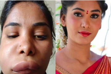 பல் சிகிச்சைக்காக சென்ற சீரியல் நடிகைக்கு ஏற்பட்ட விபரீதம் - வீட்டில் இருந்து கதறல்; அதிர்ச்சி புகைப்படம்!