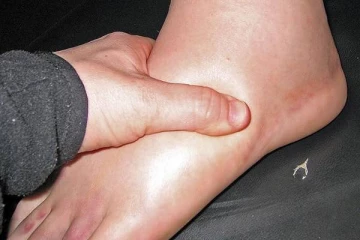 கால் அடிக்கடி வீக்கம் உண்டாகிறதா? இந்த நோயாகவும் இருக்கலாம்! எச்சரிக்கை