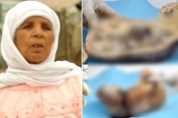 31 வயதில் கர்ப்பமாகி 92 வயதில் குழந்தை பெற்ற மூதாட்டி - எப்படி சாத்தியம்?