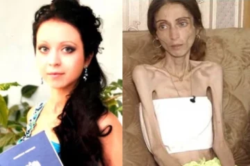 கன்னம் குண்டா இருக்கு., கணவன் சொன்னதை மிக சீரியஸாக எடுத்துக்கொண்ட பெண்