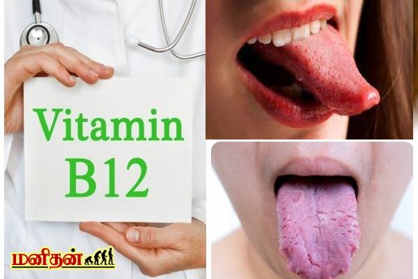 நாக்கில் இந்த அறிகுறிகள் இருக்கா? அப்போ இந்த ஆபத்து உறுதி | What Do Different Tongue Textures Mean