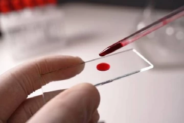 யாழில். தென்னாப்ரிக்காவிலிருந்து வந்தவரால் ஏற்பட்ட ஆபத்து