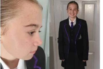 பிரித்தானியாவில் பள்ளிக்கு மூக்குத்தி அணிந்து சென்ற மாணவிக்கு நேர்ந்த நிலை! வெளியான புகைப்படம்