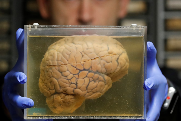 மனித மூளைக்குள் சிப் | Chip Into The Human Brain