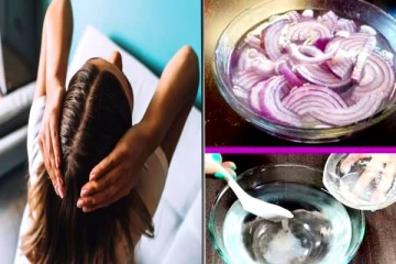 முடி உதிர்வு அதிகமாகி சொட்டையாகும் தருணத்தில் இருக்கீங்களா? அப்போ இத தடவுங்க