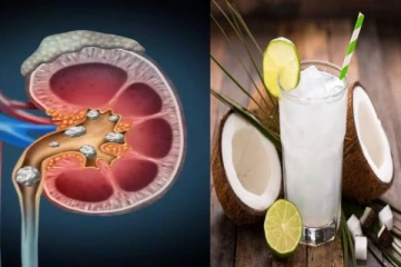 சிறுநீரக கற்களை போக்க இயற்கை பானம்! வீட்டிலேயே தயாரிக்கலாம்.