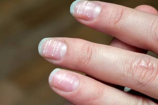 துரதிஷ்டசாலி கை விரலில் இருக்கும் இந்த அடையாளம்.. உங்களுக்கு இருக்கா? | Your Nails Might Indicate Bad Luck Shastra துரதிஷ்டசாலி கை விரலில் இருக்கும் இந்த அடையாளம்.. உங்களுக்கு இருக்கா? | Your Nails Might Indicate Bad Luck Shastra