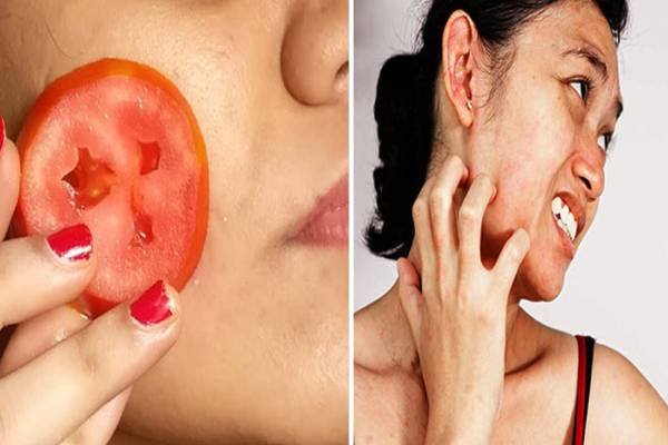 முகத்தை பளிச்சிட செய்யும் தக்காளி - எப்படி பயன்படுத்தலாம்? | Tomato For Glowing Face How To Use It முகத்தை பளிச்சிட செய்யும் தக்காளி - எப்படி பயன்படுத்தலாம்? | Tomato For Glowing Face How To Use It