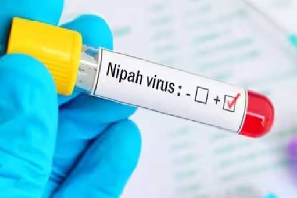 நிபா வைரஸ் நோய் தொடர்பில் வெளியான தகவல் | Information About Nipah Virus Disease