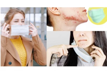 மாஸ்க் போட்டு போட்டு அலர்ஜி ஏற்படுதா? தடுக்க இதை செய்க!