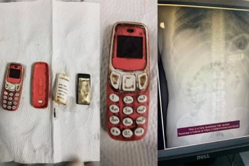 தொண்டையில் சிக்கி வயிற்றுக்கு சென்ற செல்போன்.. கதறிய இளைஞருக்கு நேர்ந்தது என்ன? வெளியான புகைப்படங்கள்