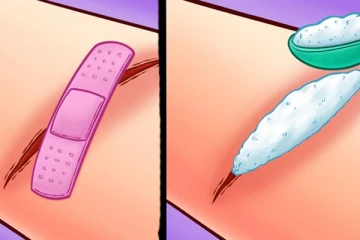 මේ සතුන් දෂ්ට කරොත් ක්ෂණිකව විෂ ඉවත් කරන ක්‍රම.