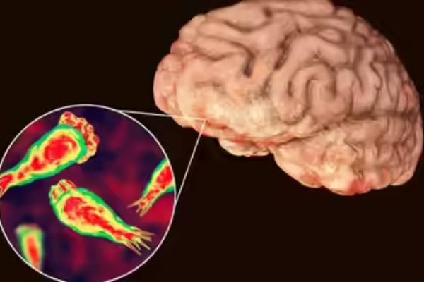 brain eating amoeba