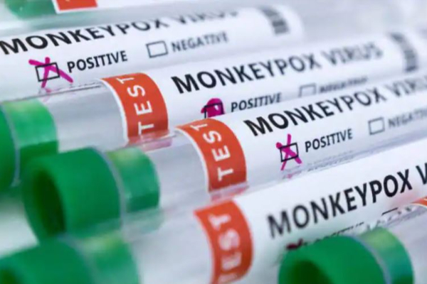 இந்தியாவுக்குள் நுழைந்ததா குரங்கு அம்மை? - அரசு வெளியிட்ட அதிர்ச்சி தகவல்! | Ghaziabad Child Sample Sent To Pune Lab Monkey Pox