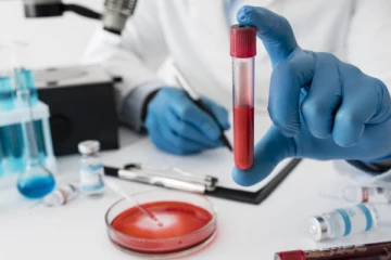 இரத்த பரிசோதனைக்கு அதிக கட்டணம்; ஆய்வகத்திற்கு 5 லட்சம் அபராதம்