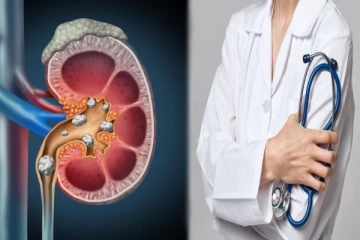 சிறுநீரக கற்கள் ஏற்படாமல் தடுக்க இதை செய்தாலே போதும்- மருத்துவரின் கூற்று